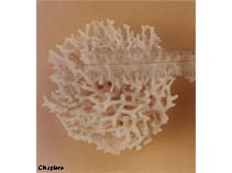 Image of Seriatopora hystrix (Thin birdsnest coral)